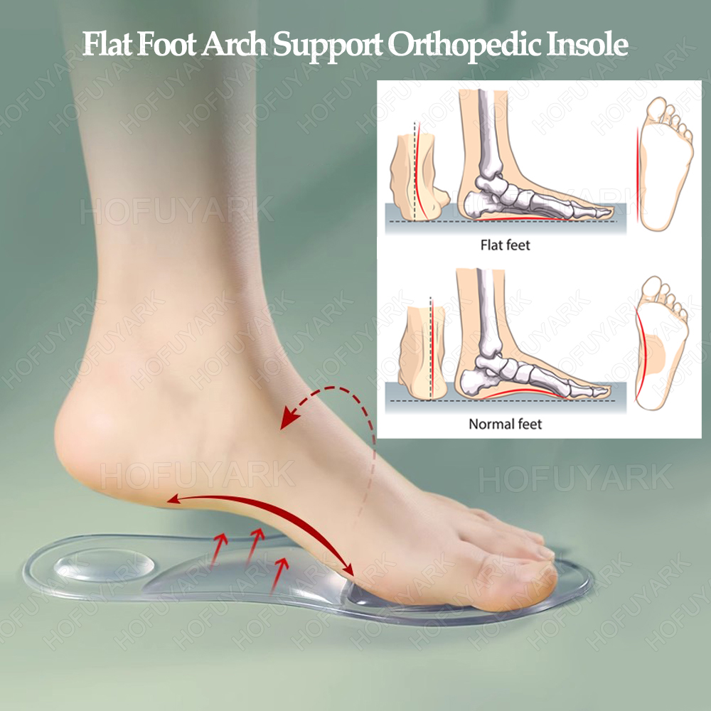 Silicone Gel Insoles Orthopedi - Women'S Shoes High Arch Support avis et prix
